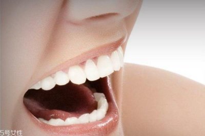 ​女人变老有什么特征 牙齿容易变脏也是征兆